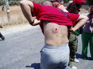 We were fleeing when a rubber bullet zipped past me and struck this man.